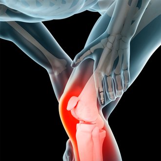 Ilustración médica de lo que parece una molestia en la rodilla. Uno de los principales y más frecuentes problemas, o lesiones, en el ciclismo.